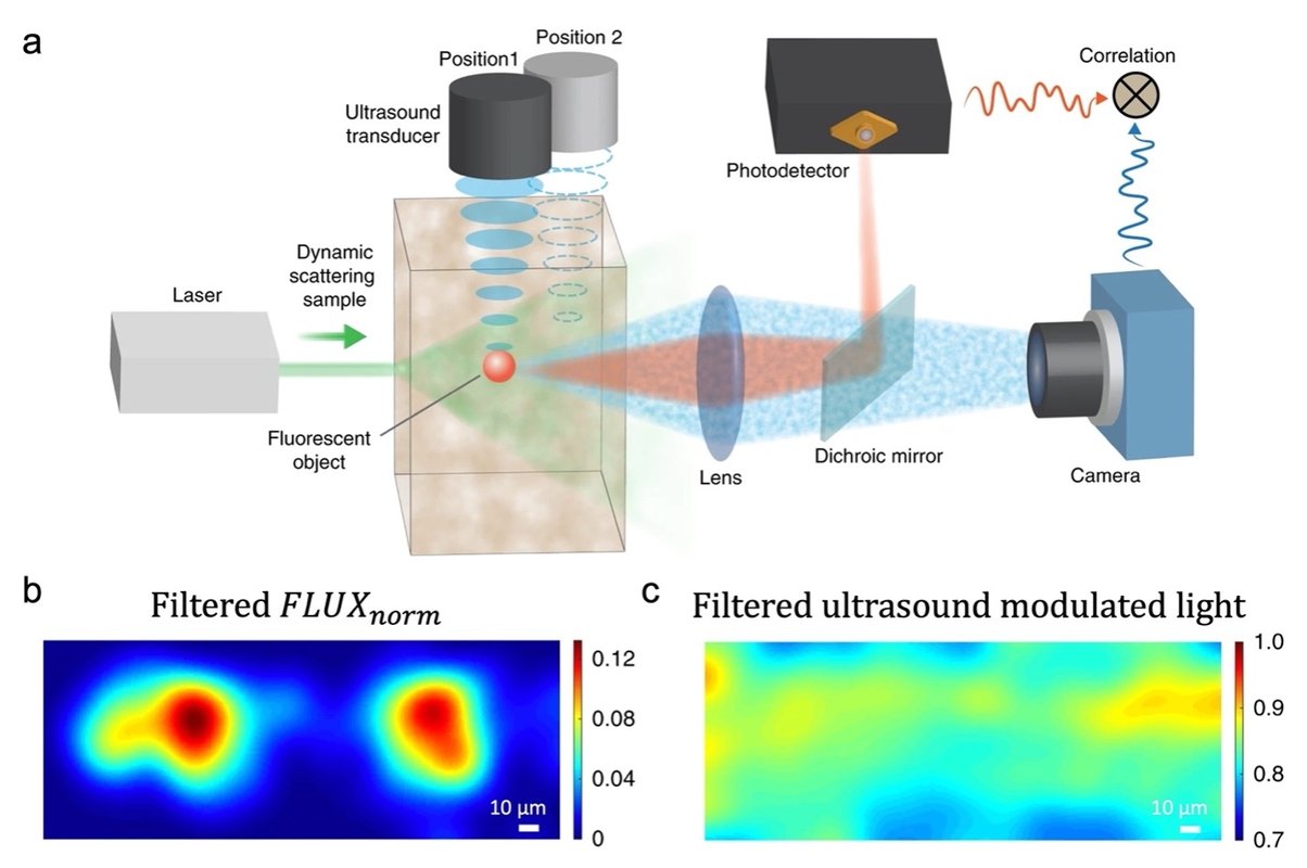 research projects in ultrasound