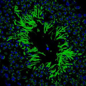 seminiferous tubule