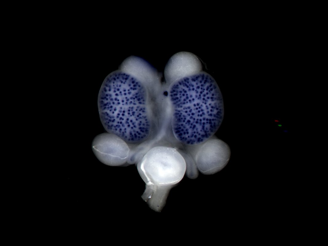 In situ staining of Lhx1 on an embryonic day 15.5 urogenital system (Image/Lisa Rutledge)