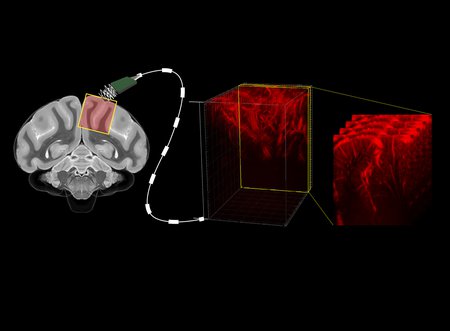 A diagram illustrating a brain connected to a cable, that reads out brain activity and creates maps of the brain's vasculature.