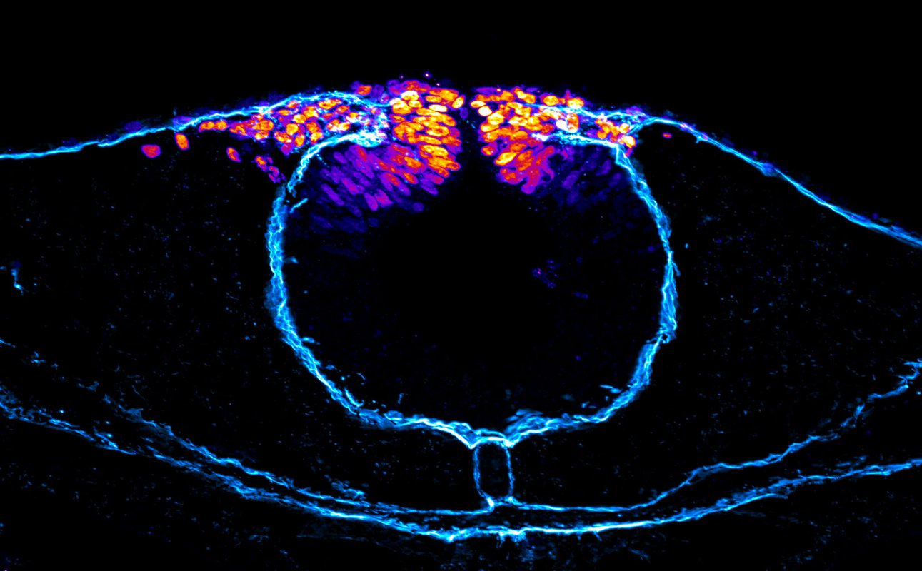 A false-colored image of neural crest cells unable to migrate