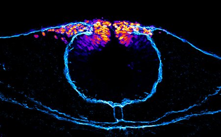 A false-colored image of neural crest cells unable to migrate