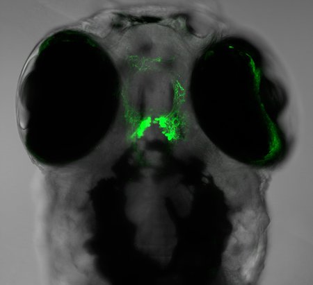 Neurons producing the sleep-promoting neuropeptide NPVF, labeled in this image with a green fluorescent protein, within the larval zebrafish brain.