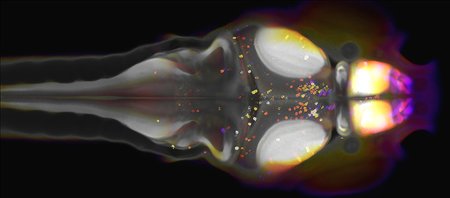 An image of a zebrafish brain with NPY-expressing neurons labeled