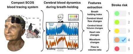 Diagram showing how SCOS blood tracing system data can be used to estimate stroke risk.