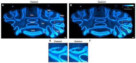 The top row shows two images of a mouse brain slice stained and glowing blue. The box on the left is labeled classical while the box on the left is labeled quantum. The bottom row shows a zoomed-in view of an area within the top row's images, which is outlined within the top images. In the bottom row, the one on the left is labeled E and classical while the one on the right is labeled F and quantum. The images on the right (those that show quantum imaging) are clearer.