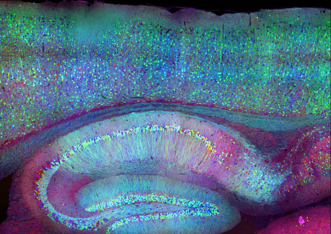 Brain image