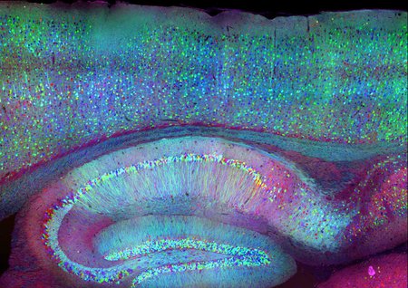 Brain image