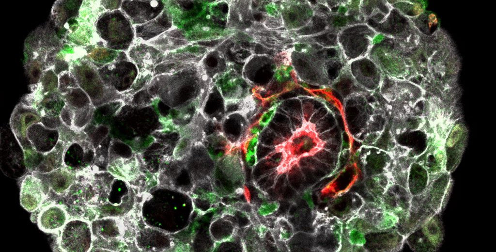 A human embryo