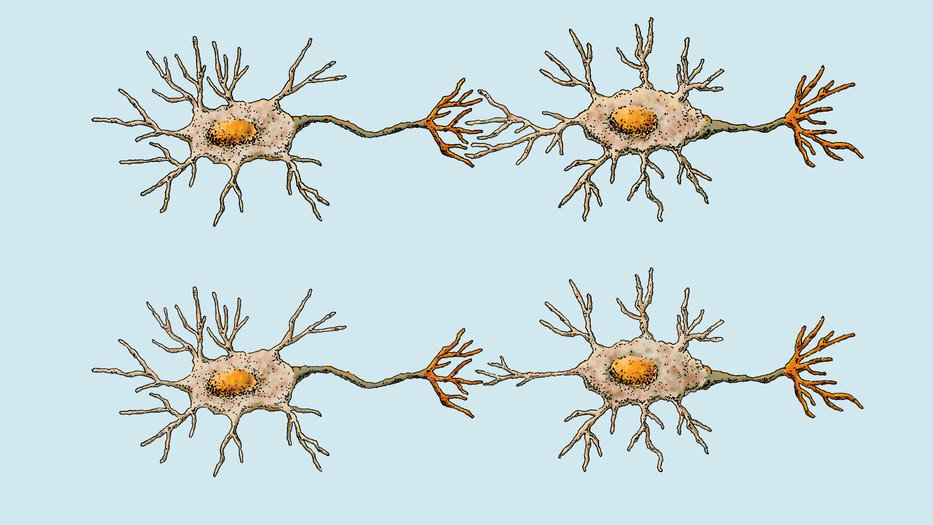 A two-part illustration showing structural changes in neurons through synaptic pruning set against a light blue background.