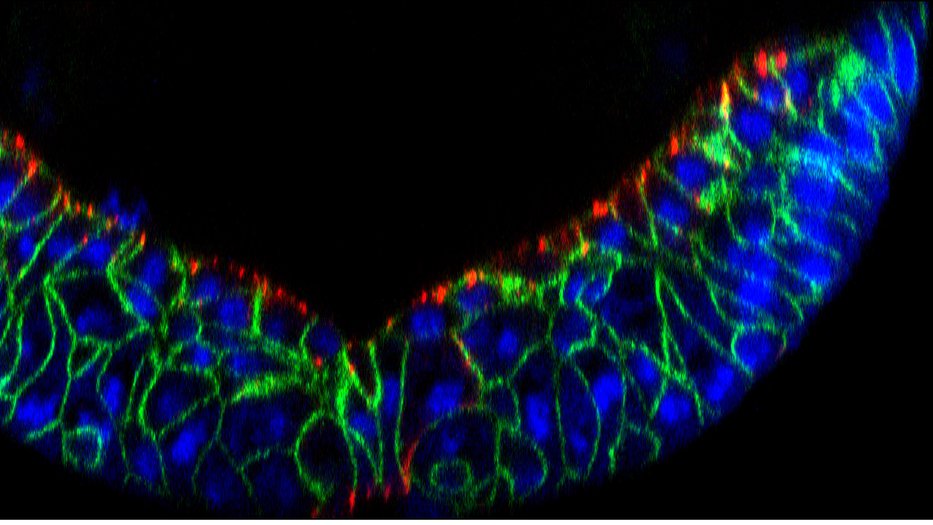 mesoderm spreading at  gastrulation